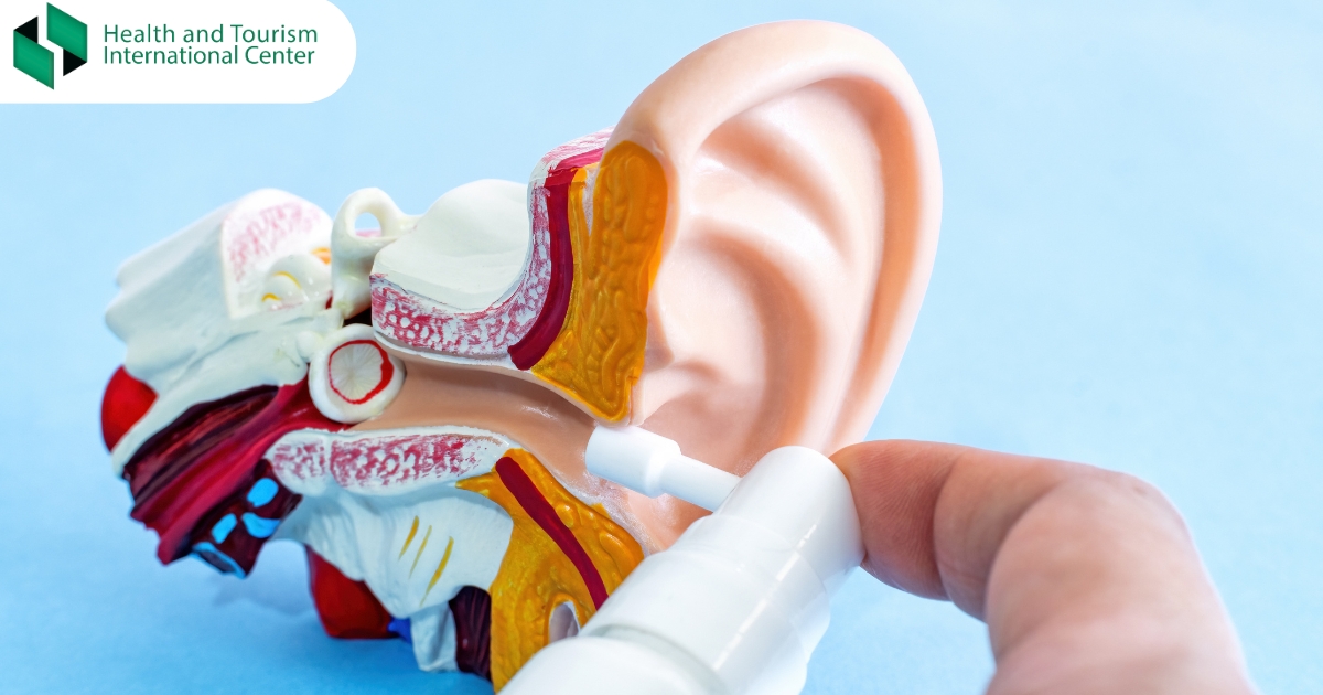 Otitis media with effusion (Glue ear)
