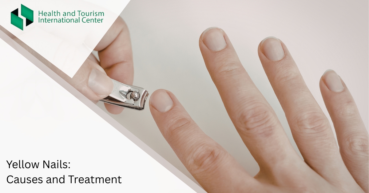 Желтый ноготь
