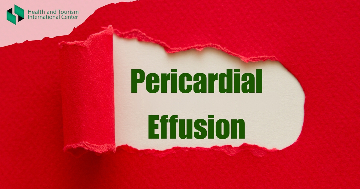 Pericardial effusion