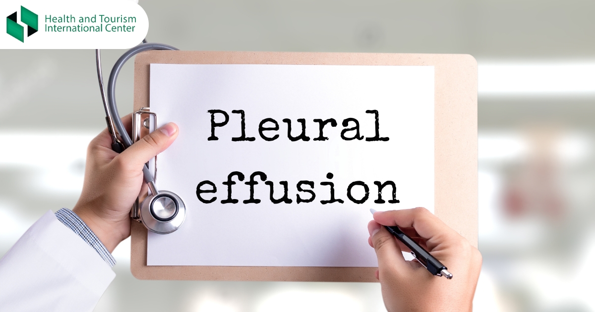 Fluid in the lung - fluid around the lung, pleural effusion