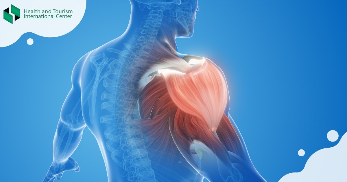Brachial plexus injury
