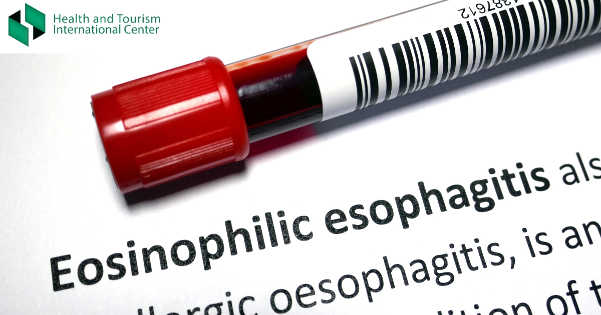 Eosinophilic Esophagitis - A Chronic Immune System Disease