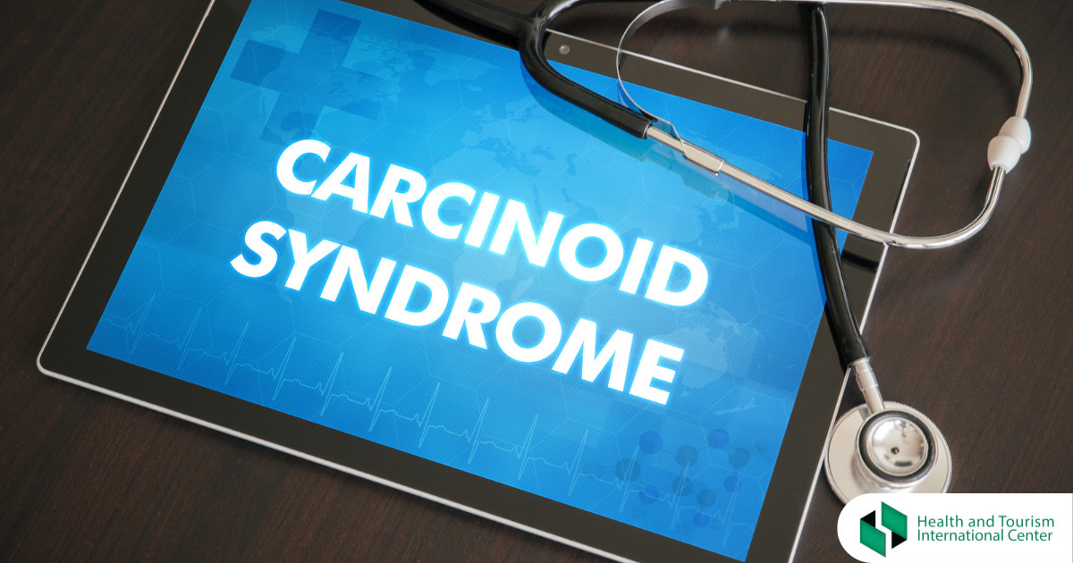 კარცინოიდული სინდრომი
