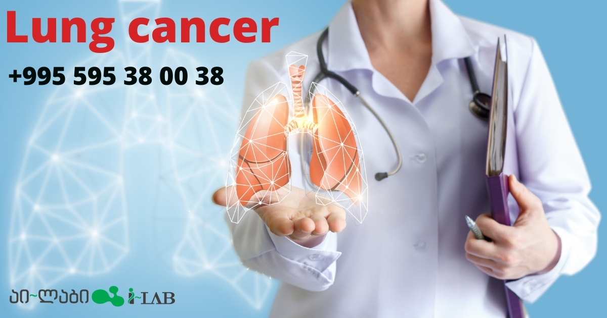 Genetic analysis and lung cancer