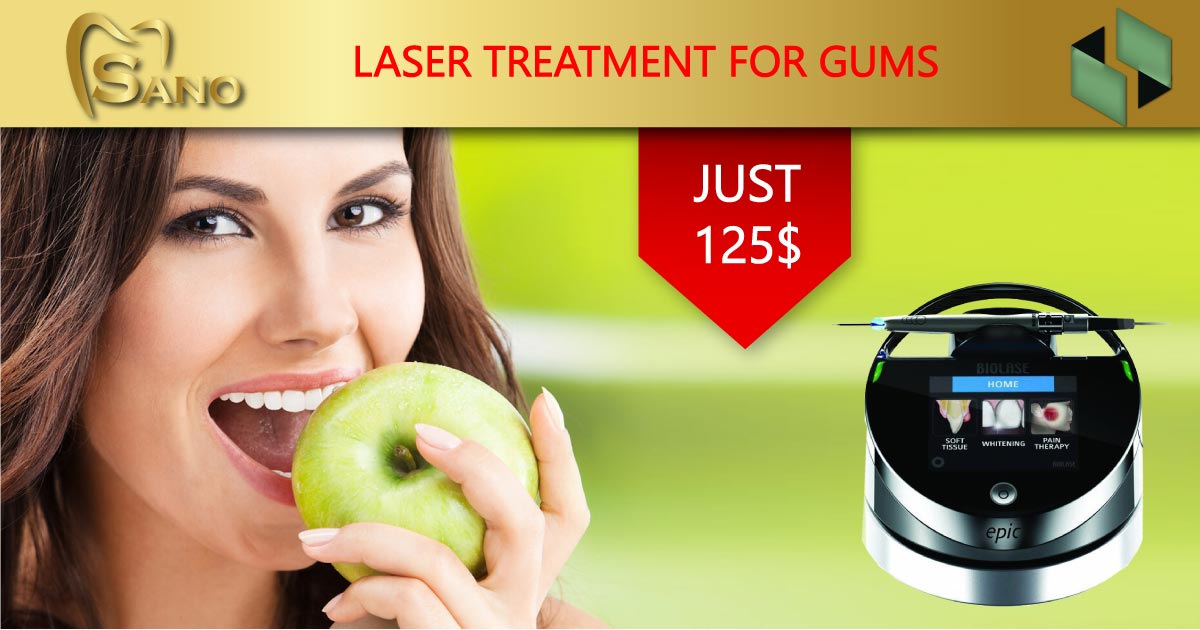 Treatment of gums with laser therapy only for 125$